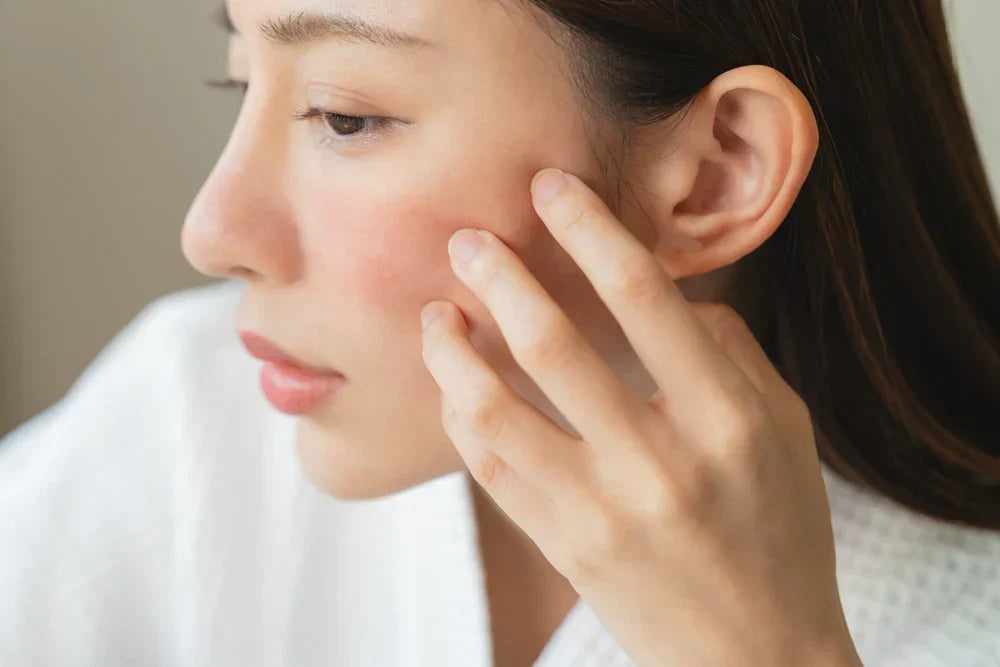 A woman gently touching her cheek, with visible redness, indicating broken capillaries on her skin.