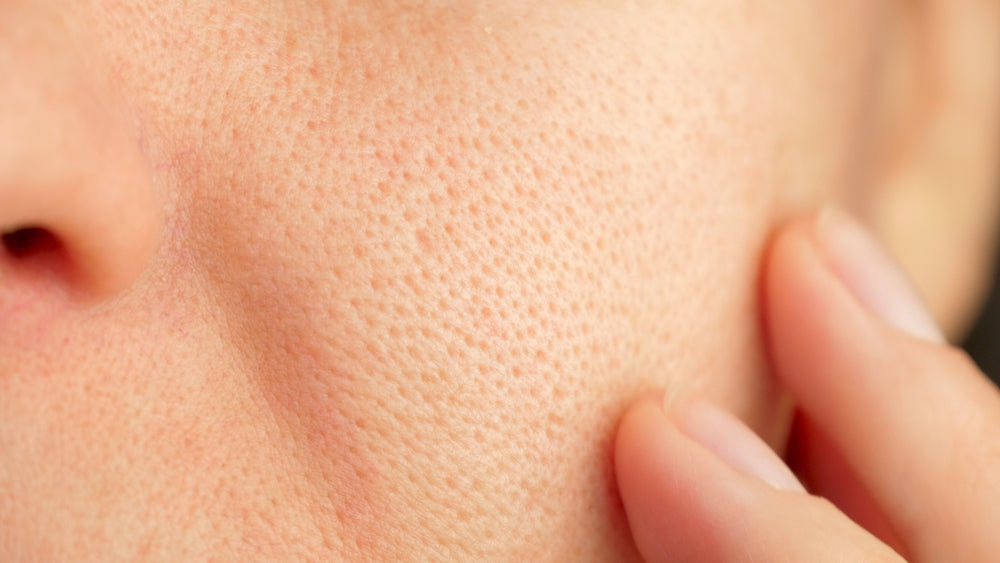 A close-up of a person's cheek, with visible texture, gently touching the skin to highlight a weakened or damaged skin barrier.